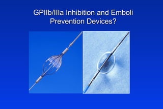 GPIIb/IIIa Inhibition and EmboliGPIIb/IIIa Inhibition and Emboli
Prevention Devices?Prevention Devices?
 