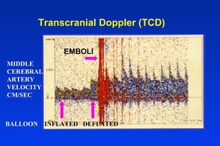 Transcranial Doppler (TCD)
MIDDLE
CEREBRAL
ARTERY
VELOCITY
CM/SEC
EMBOLI
BALLOON INFLATED DEFLATED
 