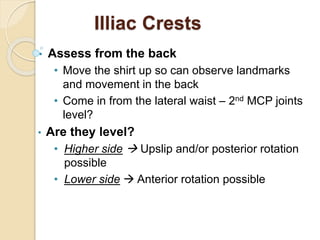 Illiac Crests
• Assess from the back
• Move the shirt up so can observe landmarks
and movement in the back
• Come in from the lateral waist – 2nd MCP joints
level?
• Are they level?
• Higher side  Upslip and/or posterior rotation
possible
• Lower side  Anterior rotation possible
 