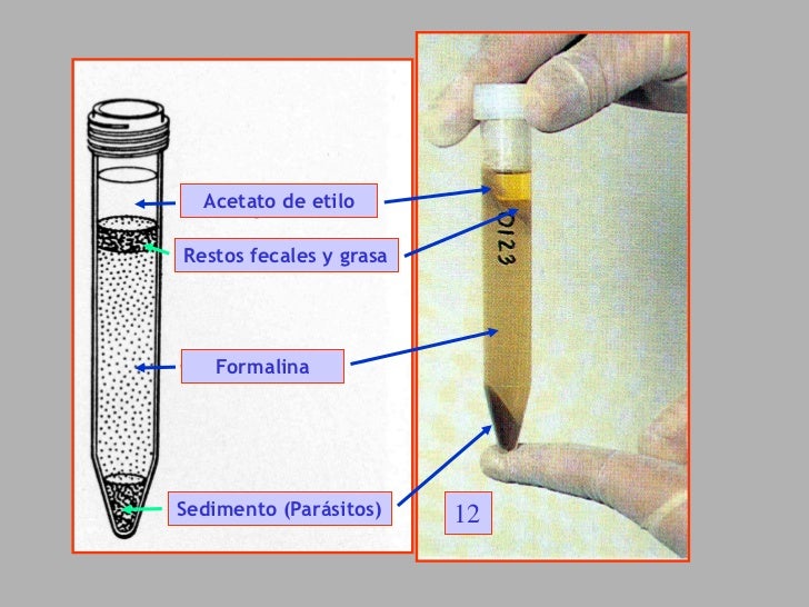 C 8 coprologia