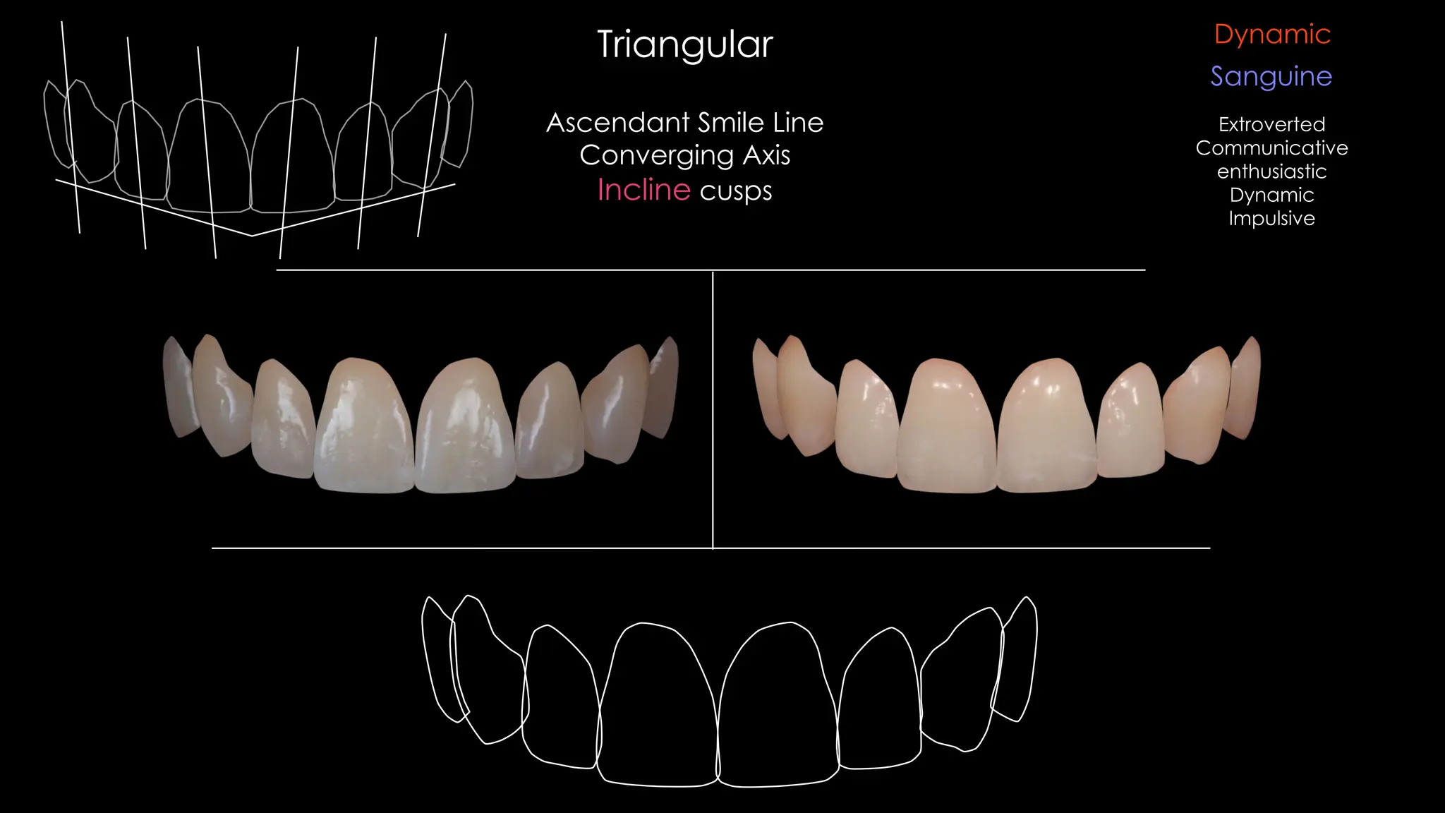 Ascendant Smile Line
Converging Axis
Incline cusps
Triangular
Sanguine
Dynamic
Extroverted
Communicative
enthusiastic
Dynamic
Impulsive
 