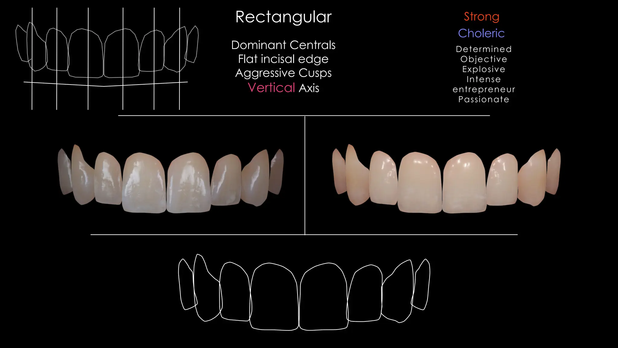 Dominant Centrals
Flat incisal edge
Aggressive Cusps
Vertical Axis
Rectangular
Choleric
Strong
Determined
Objective
Explosive
Intense
entrepreneur
Passionate
 