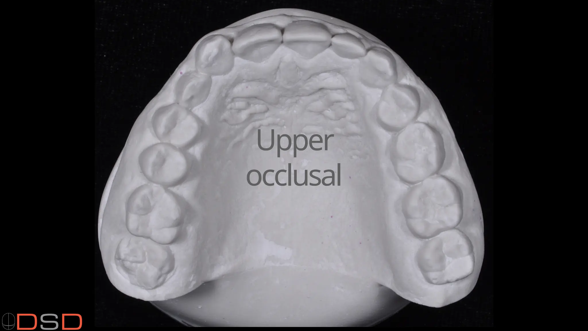 Upper
occlusal
 