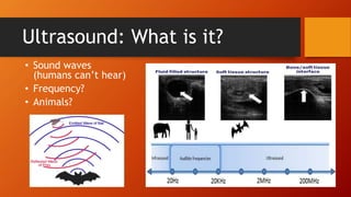 Ultrasound: What is it?
• Sound waves
(humans can’t hear)
• Frequency?
• Animals?
 
