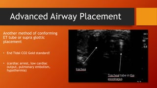 Advanced Airway Placement
Another method of conforming
ET tube or supra glottic
placement
• End Tidal CO2 Gold standard!
• (cardiac arrest, low cardiac
output, pulmonary embolism,
hypothermia)
 