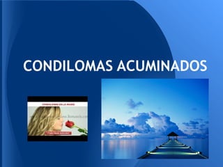 CONDILOMAS ACUMINADOS
 