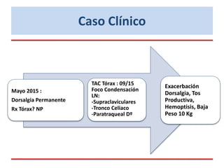 Mayo 2015 :
Dorsalgia Permanente
Rx Tórax? NP
TAC Tórax : 09/15
Foco Condensación
LN:
-Supraclaviculares
-Tronco Celiaco
-Paratraqueal Dº
Exacerbación
Dorsalgia, Tos
Productiva,
Hemoptisis, Baja
Peso 10 Kg
Caso Clínico
 