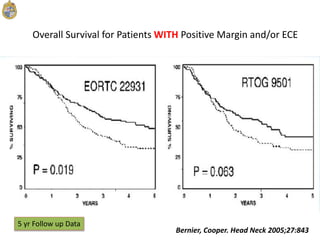 Bernier, Cooper. Head Neck 2005;27:843
Overall Survival for Patients WITH Positive Margin and/or ECE
5 yr Follow up Data
 