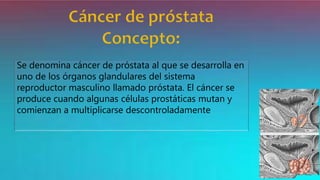 Se denomina cáncer de próstata al que se desarrolla en
uno de los órganos glandulares del sistema
reproductor masculino llamado próstata. El cáncer se
produce cuando algunas células prostáticas mutan y
comienzan a multiplicarse descontroladamente
 