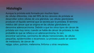 Histología
Aunque la próstata está formada por muchos tipos
de células diferentes, más del 99% de los cánceres de próstata se
desarrollan sobre células de una glándula. Las células glandulares
producen el líquido seminal que se secreta por la próstata. El término
médico del cáncer que se origina en las células glandulares se
denomina adenocarcinoma. Debido a que los otros tipos de cáncer de
próstata son muy raros, cuando se habla de cáncer de próstata, lo más
probable es que se refiera a un adenocarcinoma. Es raro
encontrar sarcomas, carcinoma de células transicionales, de células
pequeñas, epidermoides o escamosos. La próstata puede ser asiento
de metástasis, de cáncer de
vejiga, colon, pulmón, melanoma, linfoma u otras neoplasias.
 