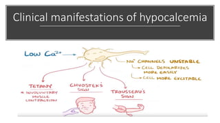 Clinical manifestations of hypocalcemia
 
