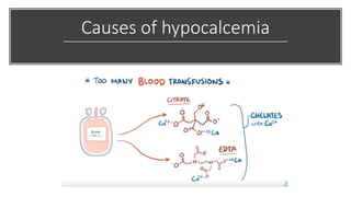 Causes of hypocalcemia
 