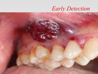 Early Detection
 