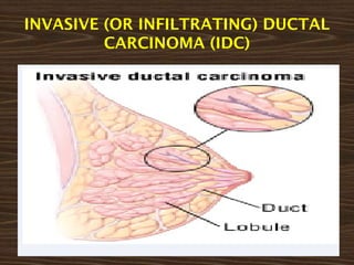 Idca Cancer Obstetrics and gynaecological nursing - Breast cancer | PPTX
