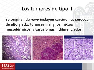 Los tumores de tipo II
Se originan de novo incluyen carcinomas serosos
de alto grado, tumores malignos mixtos
mesodérmicos, y carcinomas indiferenciados.
 