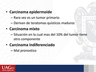 • Carcinoma epidermoide
– Rara vez es un tumor primario
– Derivan de teratomas quísticos maduros
• Carcinoma mixto
– Situación en la cual mas del 10% del tumor tiene
otro componente
• Carcinoma indiferenciado
– Mal pronostico
 