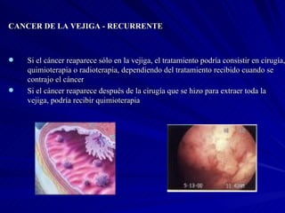 CANCER DE LA VEJIGA - RECURRENTE Si el cáncer reaparece sólo en la vejiga, el tratamiento podría consistir en cirugía, quimioterapia o radioterapia, dependiendo del tratamiento recibido cuando se contrajo el cáncer Si el cáncer reaparece después de la cirugía que se hizo para extraer toda la vejiga, podría recibir quimioterapia 