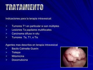 Indicaciones para la terapia intravesical: Tumores T1 en particular si son múltiples Lesiones Ta papilares multifocales Carcinoma difuso in situ Tumores  Ta, T1, o Tis Agentes mas descritos en terapia intravesical Bacilo Calmette Guerin Tiotepa Mitomicina Doxorrubicina TRATAMIENTO 