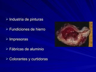 Industria de pinturas Fundiciones de hierro Impresoras Fábricas de aluminio Colorantes y curtidoras 