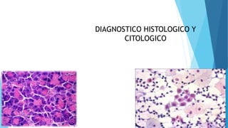 DIAGNOSTICO HISTOLOGICO Y
CITOLOGICO
 