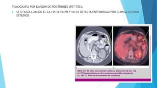 TOMOGRAFIA POR EMISION DE POSITRONES (PET-TEC):
 SE UTILIZA CUANDO EL CA 125 SE ELEVA Y NO SE DETECTA ENFERMEDAD POR CLINICA U OTROS
ESTUDIOS
 