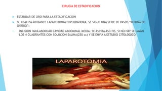 CIRUGIA DE ESTADIFICACION
 ESTANDAR DE ORO PARA LA ESTADIFICACION
 SE REALIZA MEDIANTE LAPAROTOMIA EXPLORADORA, SE SIGUE UNA SERIE DE PASOS “RUTINA DE
OVARIO”:
1. INCISION PARA ABORDAR CAVIDAD ABDOMINAL MEDIA. SE ASPIRA ASCITIS, SI NO HAY SE LAVAN
LOS 4 CUADRANTES CON SOLUCION SALINA(250 cc) Y SE ENVIA A ESTUDIO CITOLOGICO
 