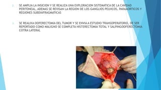 2. SE AMPLIA LA INSICION Y SE REALIZA UNA EXPLORACION SISTEMATICA DE LA CAVIDAD
PERITONEAL, ADEMAS SE REVISAN LA REGION DE LOS GANGLIOS PELVICOS, PARAAORTICOS Y
REGIONES SUBDIAFRAGMATICAS
3. SE REALIXA OOFERECTOMIA DEL TUMOR Y SE ENVIA A ESTUDIO TRANSOPERATORIO, DE SER
REPORTADO COMO MALIGNO SE COMPLETA HISTERECTOMIA TOTAL Y SALPINGOOFERECTOMIA
COTRA LATERAL
 