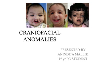 CRANIOFACIAL
ANOMALIES
PRESENTED BY
ANINDITA MALLIK
1st yr PG STUDENT
 