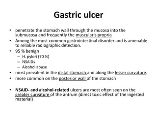 Gastric ulcer 
• penetrate the stomach wall through the mucosa into the 
submucosa and frequently the muscularis propria 
• Among the most common gastrointestinal disorder and is amenable 
to reliable radiographic detection. 
• 95 % benign 
– H. pylori (70 %) 
– NSAIDs 
– Alcohol abuse 
• most prevalent in the distal stomach and along the lesser curvature. 
• more common on the posterior wall of the stomach 
• NSAID- and alcohol-related ulcers are most often seen on the 
greater curvature of the antrum (direct toxic effect of the ingested 
material) 
 