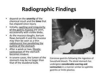 Radiographic Findings 
• depend on the severity of the 
chemical insult and the time that 
has elapsed since injury. 
• Initially, swelling and irregularity 
of the gastric mucosa are seen, 
occasionally with visible blebs. 
• As the mucosa sloughs, barium 
flows beneath it and the mucosa 
may then be seen as a thin 
radiolucent line paralleling the 
outline of the stomach. 
• After a week or two, fibrotic 
contraction of the stomach 
becomes evident. 
• In severe cases, the lumen of the 
stomach may be no larger than 
that of the duodenal bulb. 
Corrosive gastritis following the ingestion of 
household bleach. The distal stomach has 
undergone considerable scarring and 
contraction in a manner similar to syphilitic 
gastritis or linitis plastica. 
 