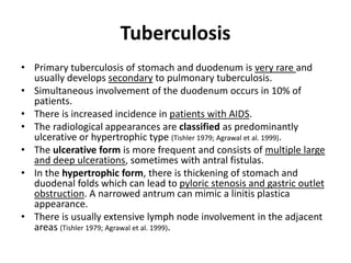 Tuberculosis 
• Primary tuberculosis of stomach and duodenum is very rare and 
usually develops secondary to pulmonary tuberculosis. 
• Simultaneous involvement of the duodenum occurs in 10% of 
patients. 
• There is increased incidence in patients with AIDS. 
• The radiological appearances are classified as predominantly 
ulcerative or hypertrophic type (Tishler 1979; Agrawal et al. 1999). 
• The ulcerative form is more frequent and consists of multiple large 
and deep ulcerations, sometimes with antral fistulas. 
• In the hypertrophic form, there is thickening of stomach and 
duodenal folds which can lead to pyloric stenosis and gastric outlet 
obstruction. A narrowed antrum can mimic a linitis plastica 
appearance. 
• There is usually extensive lymph node involvement in the adjacent 
areas (Tishler 1979; Agrawal et al. 1999). 
 