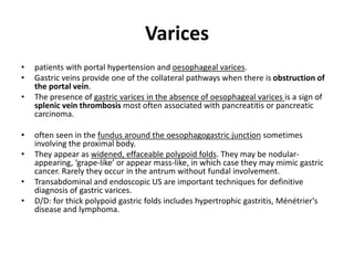 Varices 
• patients with portal hypertension and oesophageal varices. 
• Gastric veins provide one of the collateral pathways when there is obstruction of 
the portal vein. 
• The presence of gastric varices in the absence of oesophageal varices is a sign of 
splenic vein thrombosis most often associated with pancreatitis or pancreatic 
carcinoma. 
• often seen in the fundus around the oesophagogastric junction sometimes 
involving the proximal body. 
• They appear as widened, effaceable polypoid folds. They may be nodular-appearing, 
‘grape-like’ or appear mass-like, in which case they may mimic gastric 
cancer. Rarely they occur in the antrum without fundal involvement. 
• Transabdominal and endoscopic US are important techniques for definitive 
diagnosis of gastric varices. 
• D/D: for thick polypoid gastric folds includes hypertrophic gastritis, Ménétrier's 
disease and lymphoma. 
 