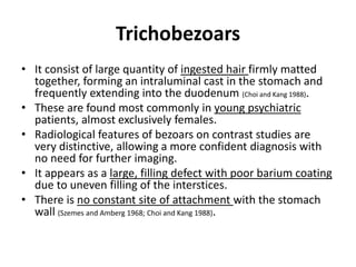 Trichobezoars 
• It consist of large quantity of ingested hair firmly matted 
together, forming an intraluminal cast in the stomach and 
frequently extending into the duodenum (Choi and Kang 1988). 
• These are found most commonly in young psychiatric 
patients, almost exclusively females. 
• Radiological features of bezoars on contrast studies are 
very distinctive, allowing a more confident diagnosis with 
no need for further imaging. 
• It appears as a large, filling defect with poor barium coating 
due to uneven filling of the interstices. 
• There is no constant site of attachment with the stomach 
wall (Szemes and Amberg 1968; Choi and Kang 1988). 
 
