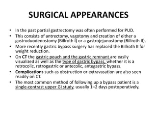 SURGICAL APPEARANCES 
• In the past partial gastrectomy was often performed for PUD. 
• This consists of antrectomy, vagotomy and creation of either a 
gastroduodenostomy (Billroth I) or a gastrojejunostomy (Billroth II). 
• More recently gastric bypass surgery has replaced the Billroth II for 
weight reduction. 
• On CT the gastric pouch and the gastric remnant are easily 
visualized as well as the type of gastric bypass, whether it is a 
retrocolic, retrogastric or antecolic, antegastric bypass. 
• Complications such as obstruction or extravasation are also seen 
readily on CT. 
• The most common method of following up a bypass patient is a 
single-contrast upper GI study, usually 1–2 days postoperatively. 
 