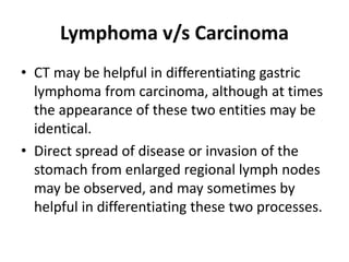 Lymphoma v/s Carcinoma 
• CT may be helpful in differentiating gastric 
lymphoma from carcinoma, although at times 
the appearance of these two entities may be 
identical. 
• Direct spread of disease or invasion of the 
stomach from enlarged regional lymph nodes 
may be observed, and may sometimes by 
helpful in differentiating these two processes. 
 