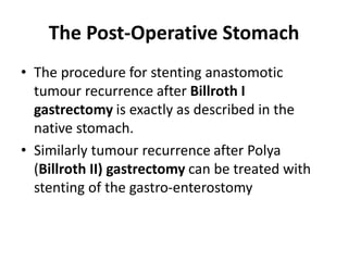 The Post-Operative Stomach 
• The procedure for stenting anastomotic 
tumour recurrence after Billroth I 
gastrectomy is exactly as described in the 
native stomach. 
• Similarly tumour recurrence after Polya 
(Billroth II) gastrectomy can be treated with 
stenting of the gastro-enterostomy 
 