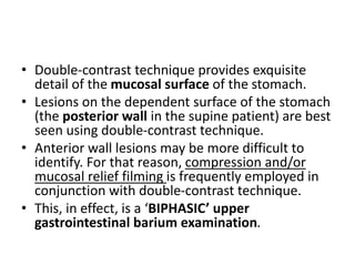 • Double-contrast technique provides exquisite 
detail of the mucosal surface of the stomach. 
• Lesions on the dependent surface of the stomach 
(the posterior wall in the supine patient) are best 
seen using double-contrast technique. 
• Anterior wall lesions may be more difficult to 
identify. For that reason, compression and/or 
mucosal relief filming is frequently employed in 
conjunction with double-contrast technique. 
• This, in effect, is a ‘BIPHASIC’ upper 
gastrointestinal barium examination. 
 
