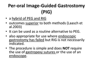 Per-oral Image-Guided Gastrostomy 
(PIG) 
• a hybrid of PEG and RIG 
• outcomes superior to both methods (Laasch et 
al.2003) 
• It can be used as a routine alternative to PEG. 
• also appropriate for use where endoscopic 
gastrostomy has failed but RIG is not necessarily 
indicated. 
• The procedure is simple and does NOT require 
the use of gastropexy sutures or the use of an 
endoscope. 
 