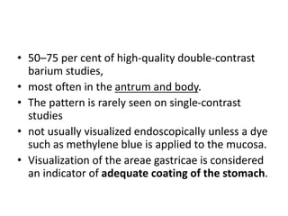 • 50–75 per cent of high-quality double-contrast 
barium studies, 
• most often in the antrum and body. 
• The pattern is rarely seen on single-contrast 
studies 
• not usually visualized endoscopically unless a dye 
such as methylene blue is applied to the mucosa. 
• Visualization of the areae gastricae is considered 
an indicator of adequate coating of the stomach. 
 