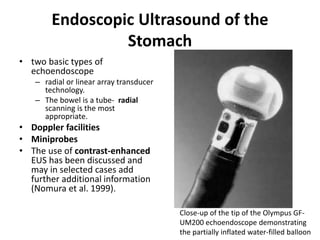 Endoscopic Ultrasound of the 
Stomach 
• two basic types of 
echoendoscope 
– radial or linear array transducer 
technology. 
– The bowel is a tube- radial 
scanning is the most 
appropriate. 
• Doppler facilities 
• Miniprobes 
• The use of contrast-enhanced 
EUS has been discussed and 
may in selected cases add 
further additional information 
(Nomura et al. 1999). 
Close-up of the tip of the Olympus GF-UM200 
echoendoscope demonstrating 
the partially inflated water-filled balloon 
 