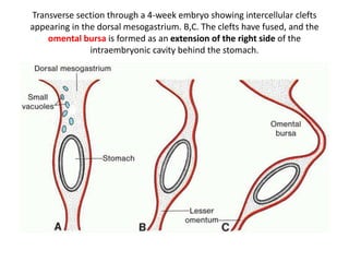 Transverse section through a 4-week embryo showing intercellular clefts 
appearing in the dorsal mesogastrium. B,C. The clefts have fused, and the 
omental bursa is formed as an extension of the right side of the 
intraembryonic cavity behind the stomach. 
 