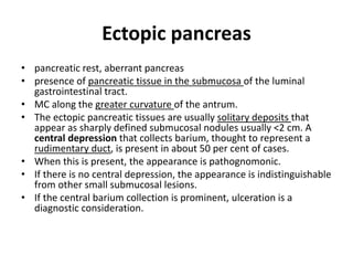 Ectopic pancreas 
• pancreatic rest, aberrant pancreas 
• presence of pancreatic tissue in the submucosa of the luminal 
gastrointestinal tract. 
• MC along the greater curvature of the antrum. 
• The ectopic pancreatic tissues are usually solitary deposits that 
appear as sharply defined submucosal nodules usually <2 cm. A 
central depression that collects barium, thought to represent a 
rudimentary duct, is present in about 50 per cent of cases. 
• When this is present, the appearance is pathognomonic. 
• If there is no central depression, the appearance is indistinguishable 
from other small submucosal lesions. 
• If the central barium collection is prominent, ulceration is a 
diagnostic consideration. 
 