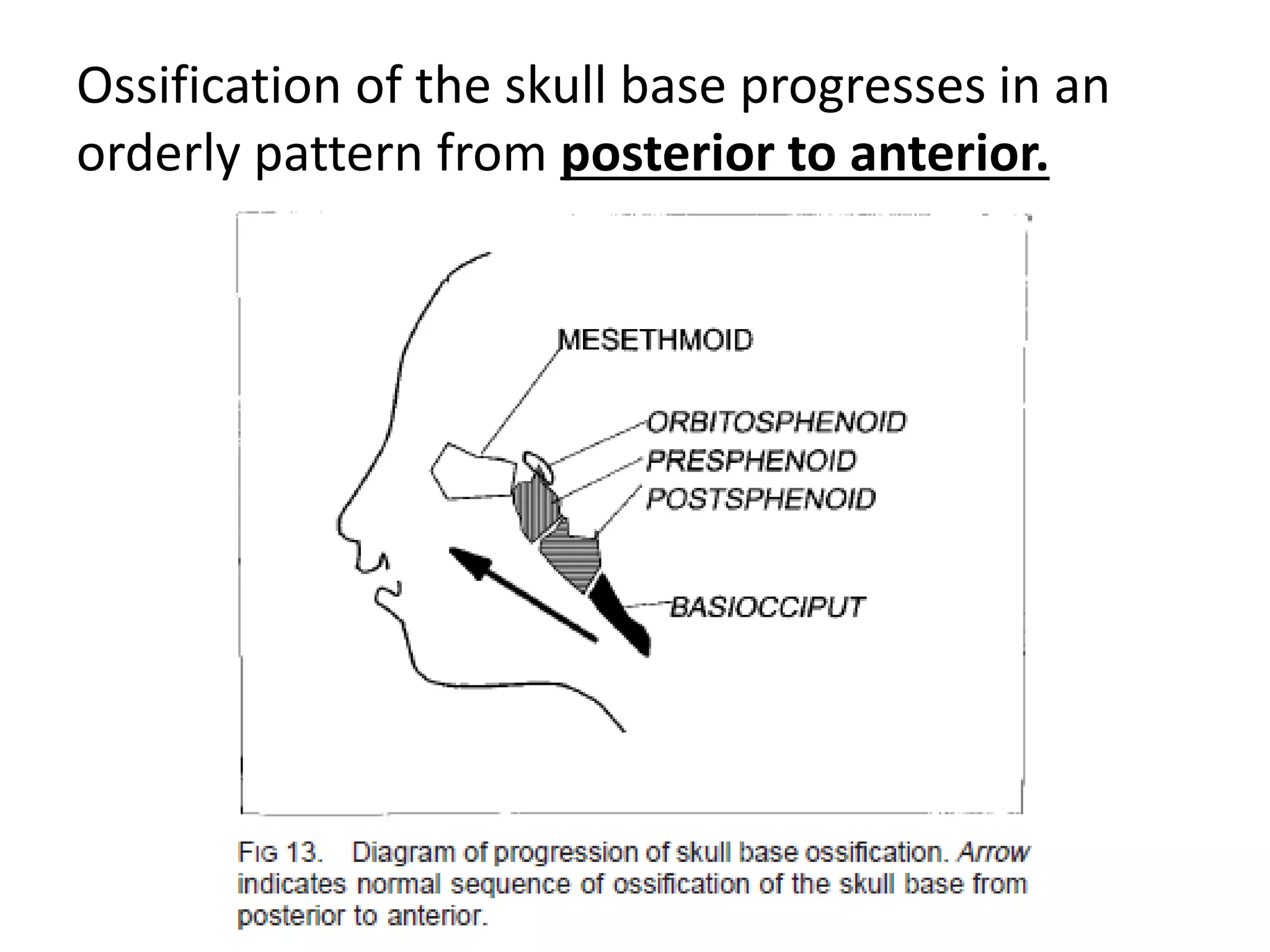 Imaging in Skull base | PPTX