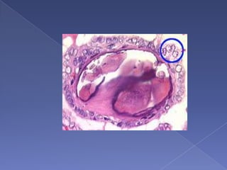 Labs & investigations(cont.....)FNACTrucut biopsyIncisional biopsyUSG neckCT scan neck & thoraxMRI Thyroid scan