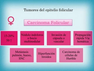 Tumores del epitelio folicular
Carcinoma Folicular
15-20%
50 ↑
Nódulo indoloros
o bocio
multinodular
Invasión de
cápsula o
vascular
Propagación
rápida Vía
hemática
Metástasis
pulmón, hueso,
SNC
Hiperfunción
tiroidea
Carcinoma de
células de
Hurthle
 