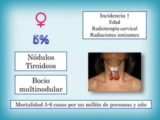 Nódulos
Tiroideos
Mortalidad 5-6 casos por un millón de personas y año
Bocio
multinodular
Incidencia ↑
Edad
Radioterapia cervical
Radiaciones ionizantes
 