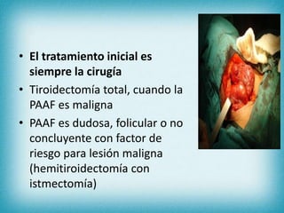 • El tratamiento inicial es
siempre la cirugía
• Tiroidectomía total, cuando la
PAAF es maligna
• PAAF es dudosa, folicular o no
concluyente con factor de
riesgo para lesión maligna
(hemitiroidectomía con
istmectomía)
 