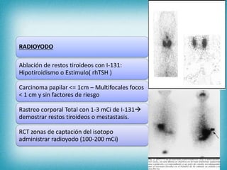 RADIOYODO
Ablación de restos tiroideos con I-131:
Hipotiroidismo o Estimulo( rhTSH )
Carcinoma papilar <= 1cm – Multifocales focos
< 1 cm y sin factores de riesgo
Rastreo corporal Total con 1-3 mCi de I-131
demostrar restos tiroideos o mestastasis.
RCT zonas de captación del isotopo
administrar radioyodo (100-200 mCi)
 