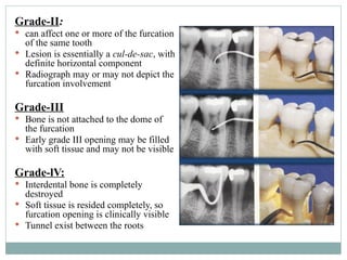Grade-II:
 can affect one or more of the furcation
of the same tooth
 Lesion is essentially a cul-de-sac, with
definite horizontal component
 Radiograph may or may not depict the
furcation involvement
Grade-III
 Bone is not attached to the dome of
the furcation
 Early grade III opening may be filled
with soft tissue and may not be visible
Grade-lV:
 Interdental bone is completely
destroyed
 Soft tissue is resided completely, so
furcation opening is clinically visible
 Tunnel exist between the roots
 