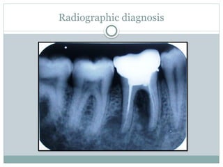 Radiographic diagnosis
 